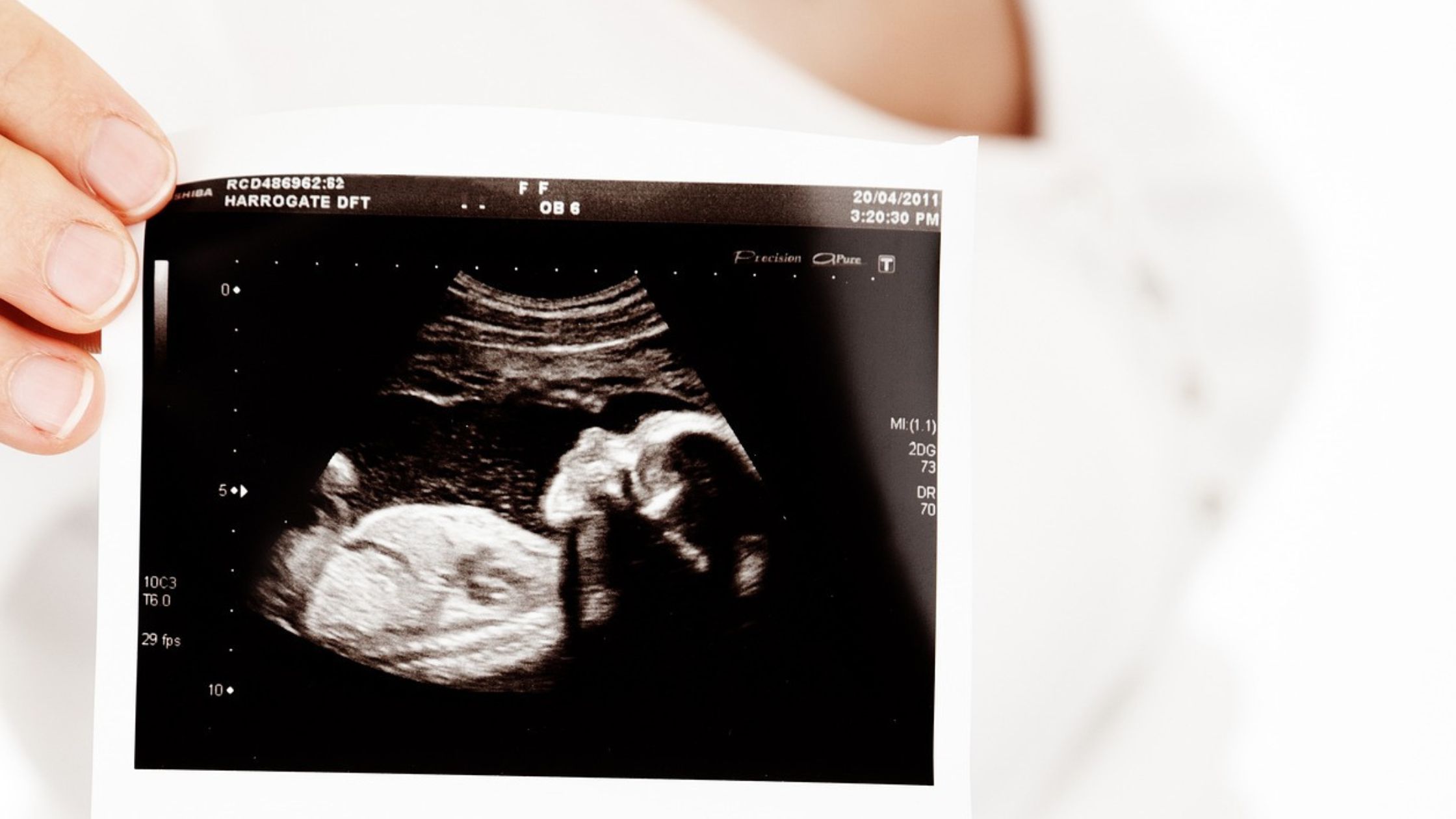 Are ultrasounds safe